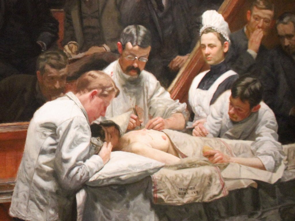 Crop of an oil painting. The Agnew Clinic (or The Clinic of Dr. Agnew) an 1889 oil painting by American artist Thomas Eakins. It shows three male doctors operating on a patient. A female nurse looks on.