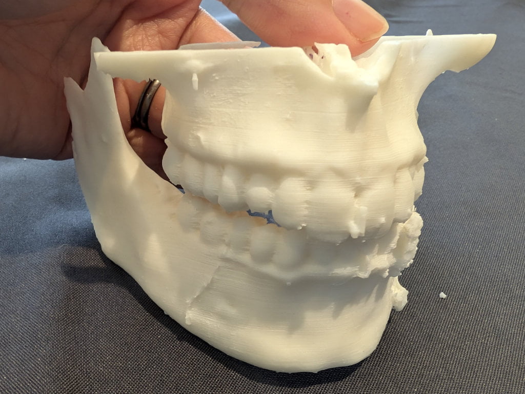 Life sized 3D printed teeth.